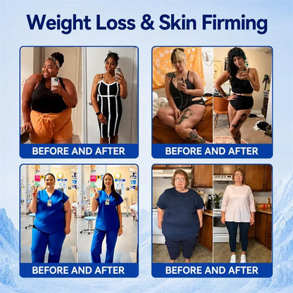 PURELORA® 4 in 1 Cryogenic Mist Adaptive fat shaping, intelligent cooling, skin protection and coolness technology.